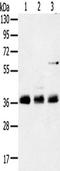 Ankyrin repeat domain-containing protein 1 antibody, TA349471, Origene, Western Blot image 
