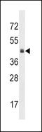 Kruppel Like Factor 12 antibody, LS-C165551, Lifespan Biosciences, Western Blot image 