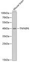 TNF Alpha Induced Protein 6 antibody, 22-206, ProSci, Western Blot image 