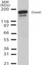 DNA Methyltransferase 1 antibody, 49-761, ProSci, Western Blot image 
