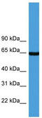 Asparagine Synthetase (Glutamine-Hydrolyzing) antibody, TA342876, Origene, Western Blot image 