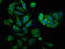 Proteasome 26S Subunit, ATPase 3 antibody, LS-C396551, Lifespan Biosciences, Immunofluorescence image 