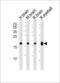 Visinin Like 1 antibody, LS-C97748, Lifespan Biosciences, Western Blot image 