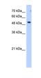 Sulfatase 2 antibody, orb330580, Biorbyt, Western Blot image 