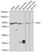 Chitobiosyldiphosphodolichol beta-mannosyltransferase antibody, A05643, Boster Biological Technology, Western Blot image 