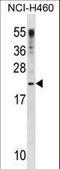 Colony Stimulating Factor 3 antibody, LS-C157665, Lifespan Biosciences, Western Blot image 