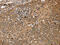 N-Myristoyltransferase 1 antibody, CSB-PA904948, Cusabio, Immunohistochemistry paraffin image 