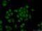 Promyelocytic Leukemia antibody, 21041-1-AP, Proteintech Group, Immunofluorescence image 