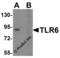 Toll-like receptor 6 antibody, 3651, ProSci Inc, Western Blot image 