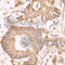 Catenin Delta 1 antibody, A1641, ABclonal Technology, Immunohistochemistry paraffin image 
