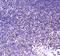 Core-Binding Factor Subunit Beta antibody, A01007-1, Boster Biological Technology, Immunohistochemistry paraffin image 
