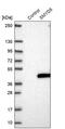 SMYD Family Member 5 antibody, PA5-61859, Invitrogen Antibodies, Western Blot image 