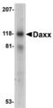 Death Domain Associated Protein antibody, A00439, Boster Biological Technology, Western Blot image 