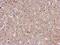 Fermitin Family Member 2 antibody, GTX118359, GeneTex, Immunohistochemistry paraffin image 