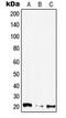 Calcium And Integrin Binding Family Member 4 antibody, LS-C353863, Lifespan Biosciences, Western Blot image 