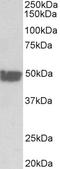 Keratin 20 antibody, STJ72886, St John