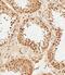 Proteasome 26S Subunit, Non-ATPase 3 antibody, M08767, Boster Biological Technology, Immunohistochemistry paraffin image 