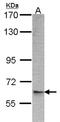 ADP Ribosylation Factor GTPase Activating Protein 3 antibody, NBP1-31064, Novus Biologicals, Western Blot image 