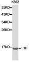 Fragile Histidine Triad Diadenosine Triphosphatase antibody, TA326988, Origene, Western Blot image 