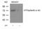 Activating Transcription Factor 2 antibody, PA5-37531, Invitrogen Antibodies, Western Blot image 