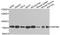 Zinc Finger Protein 408 antibody, orb374177, Biorbyt, Western Blot image 