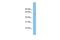 Arg1 antibody, GTX44884, GeneTex, Western Blot image 