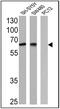 Nerve Growth Factor Receptor antibody, MA5-13311, Invitrogen Antibodies, Western Blot image 