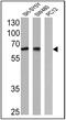 Nerve Growth Factor Receptor antibody, MA5-13311, Invitrogen Antibodies, Western Blot image 