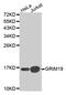 NADH:Ubiquinone Oxidoreductase Subunit A13 antibody, MBS128052, MyBioSource, Western Blot image 