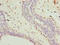 Transmembrane Protein 161A antibody, A61370-100, Epigentek, Immunohistochemistry paraffin image 