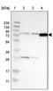 Chloride Voltage-Gated Channel 2 antibody, PA5-53189, Invitrogen Antibodies, Western Blot image 