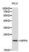 Natriuretic Peptide A antibody, LS-C192849, Lifespan Biosciences, Western Blot image 