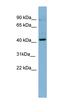 Protein Kinase C Beta antibody, orb326103, Biorbyt, Western Blot image 