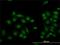 Lysine Demethylase 5B antibody, H00010765-M02, Novus Biologicals, Immunocytochemistry image 