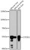 Cytochrome P450 Family 2 Subfamily E Member 1 antibody, GTX32546, GeneTex, Western Blot image 