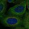 TBC1 Domain Family Member 2B antibody, HPA041833, Atlas Antibodies, Immunofluorescence image 