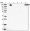 Alpha-2-Macroglobulin Like 1 antibody, NBP1-84392, Novus Biologicals, Western Blot image 