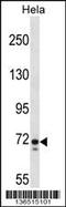 Polypeptide N-Acetylgalactosaminyltransferase 6 antibody, 58-738, ProSci, Western Blot image 