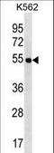 Lymphocyte Transmembrane Adaptor 1 antibody, LS-C160033, Lifespan Biosciences, Western Blot image 