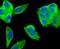 Matrix Metallopeptidase 11 antibody, NBP2-67670, Novus Biologicals, Immunocytochemistry image 