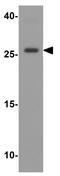 Vesicle Transport Through Interaction With T-SNAREs 1A antibody, GTX31627, GeneTex, Western Blot image 