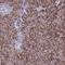 Aldehyde Dehydrogenase 1 Family Member L2 antibody, NBP1-81935, Novus Biologicals, Immunohistochemistry frozen image 