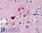 Cyclin Dependent Kinase 5 antibody, LS-B353, Lifespan Biosciences, Immunohistochemistry paraffin image 