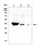 Hydroxy-Delta-5-Steroid Dehydrogenase, 3 Beta- And Steroid Delta-Isomerase 1 antibody, A02856-2, Boster Biological Technology, Western Blot image 