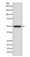 Protein Kinase CAMP-Dependent Type II Regulatory Subunit Alpha antibody, P03911, Boster Biological Technology, Western Blot image 