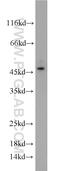 Kallikrein 1 antibody, 10815-1-AP, Proteintech Group, Western Blot image 