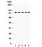 Solute Carrier Family 4 Member 1 (Diego Blood Group) antibody, R31868, NSJ Bioreagents, Western Blot image 