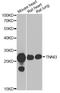 Troponin I3, Cardiac Type antibody, A6995, ABclonal Technology, Western Blot image 