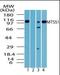 MTSS I-BAR Domain Containing 1 antibody, orb87666, Biorbyt, Western Blot image 