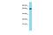 EF-Hand And Coiled-Coil Domain Containing 1 antibody, PA5-46240, Invitrogen Antibodies, Western Blot image 